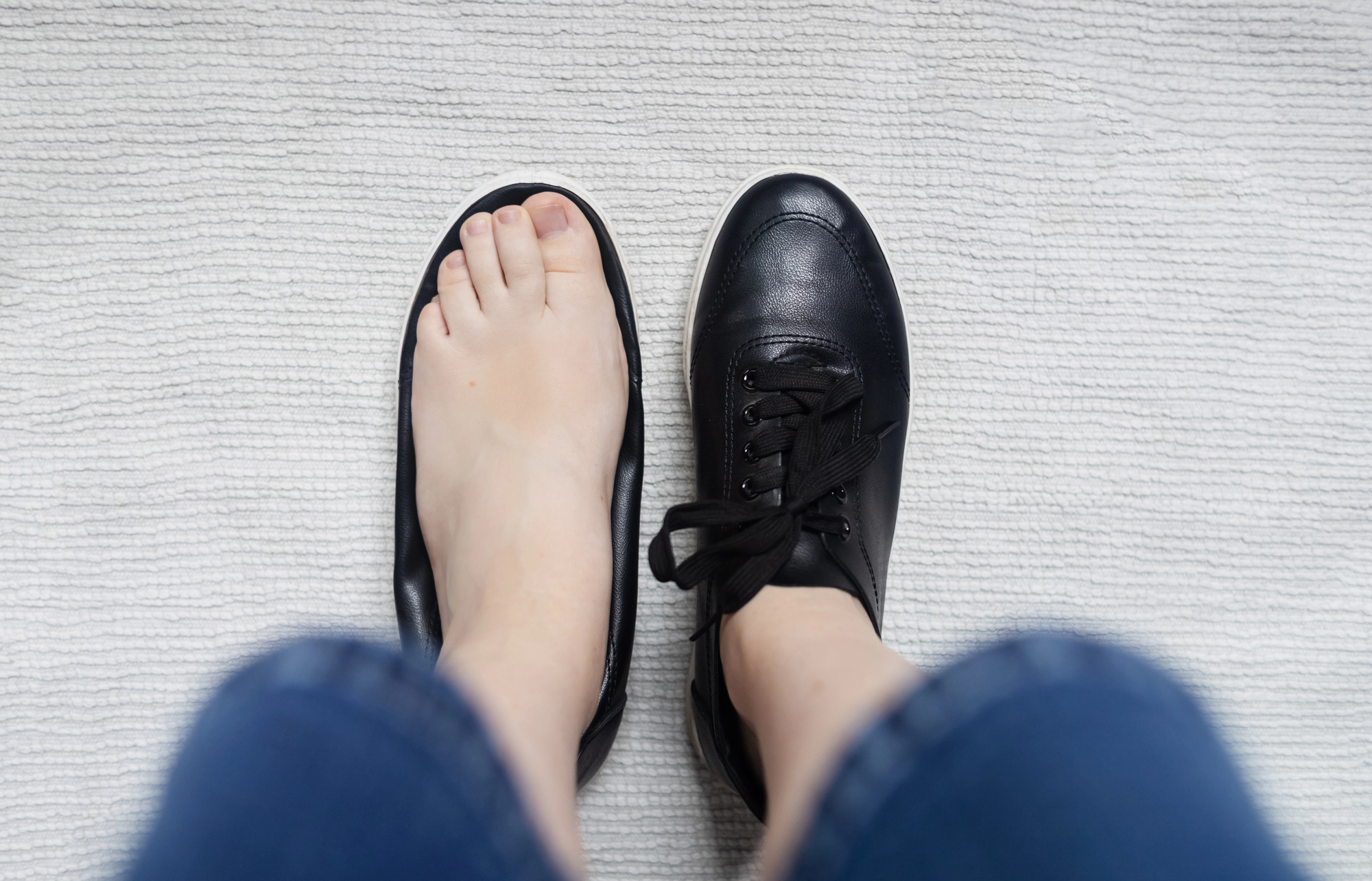 Foot next to a tight dress shoe, representing how narrow or poorly fitting footwear can contribute to ingrown toenails. | Chesapeak Foot and Ankle Institute | Podiatrist in Vienna, VA